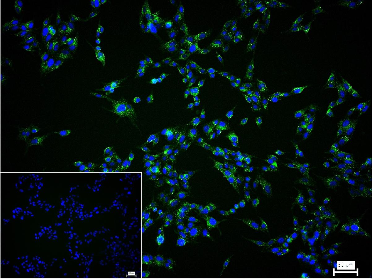 甲状腺球蛋白重组兔单抗-bsm-63331R