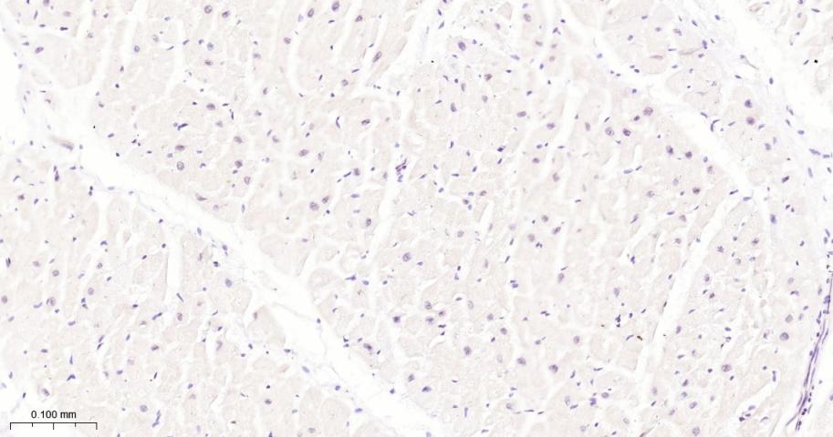 泛素特异性蛋白酶28重组兔单抗
