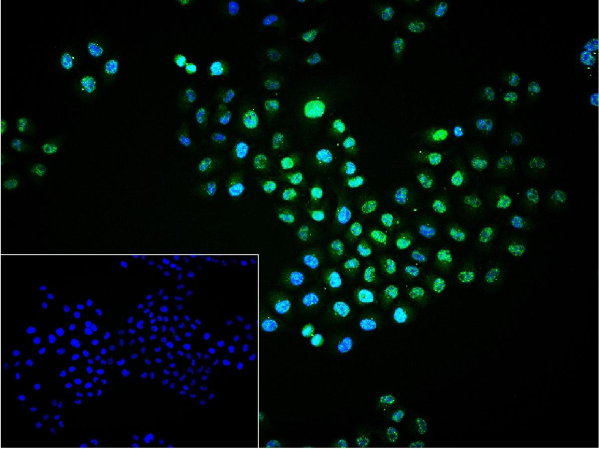 磷酸化丝裂原活化蛋白激酶1/2抗体