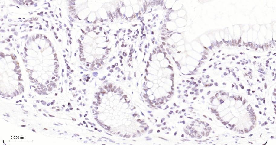 泛素特异性蛋白酶28重组兔单抗