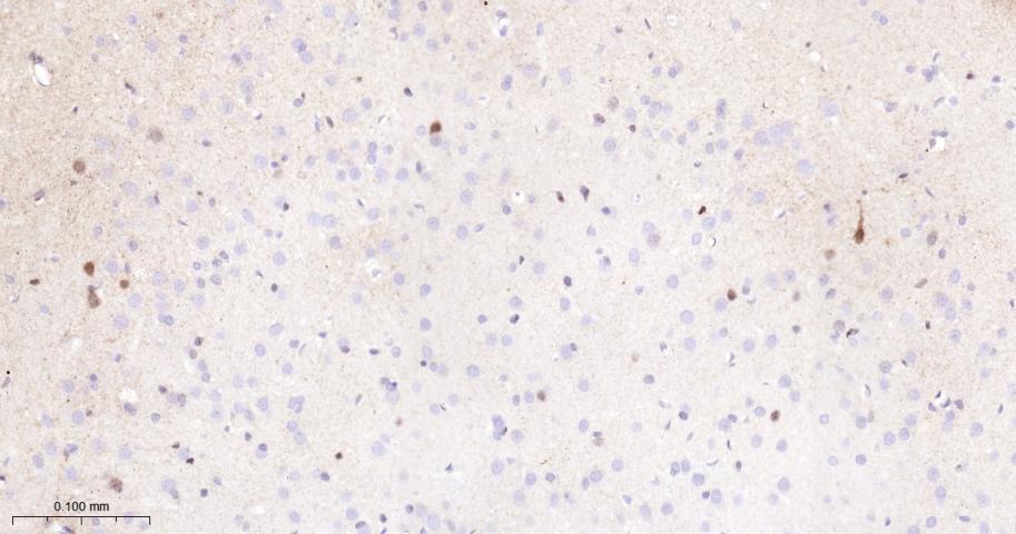 磷酸化丝裂原活化蛋白激酶1/2抗体