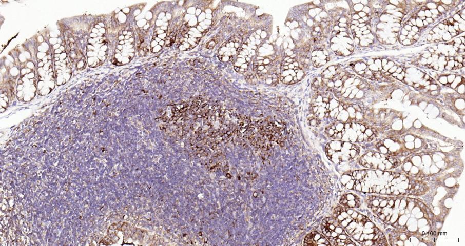 Ras GTP酶活化蛋白结合蛋白1重组兔单抗