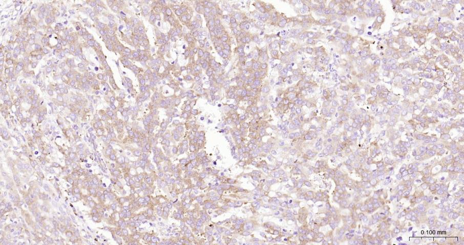 Ras GTP酶活化蛋白结合蛋白1重组兔单抗