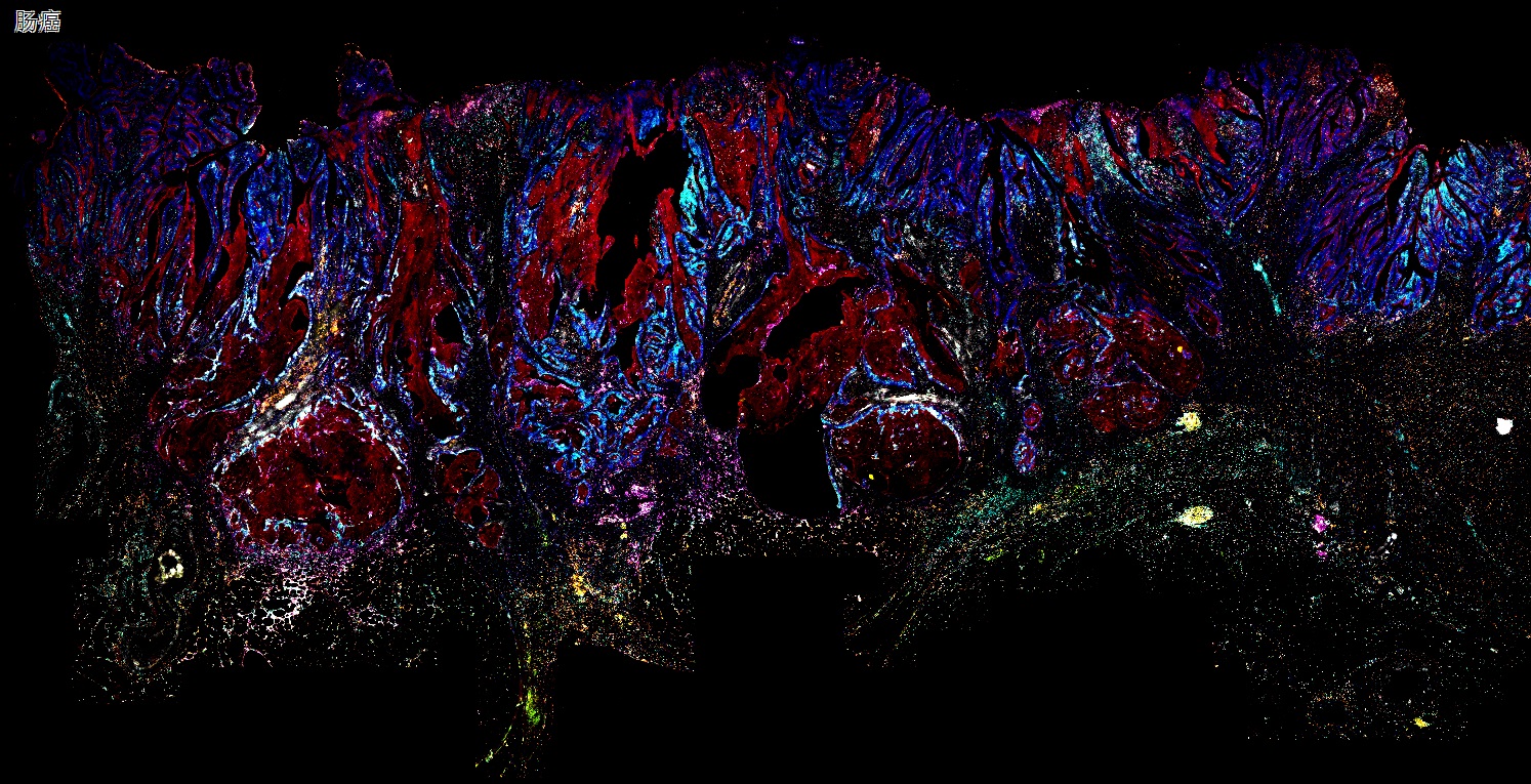 六标七色多重荧光检测试剂盒-IHCT005