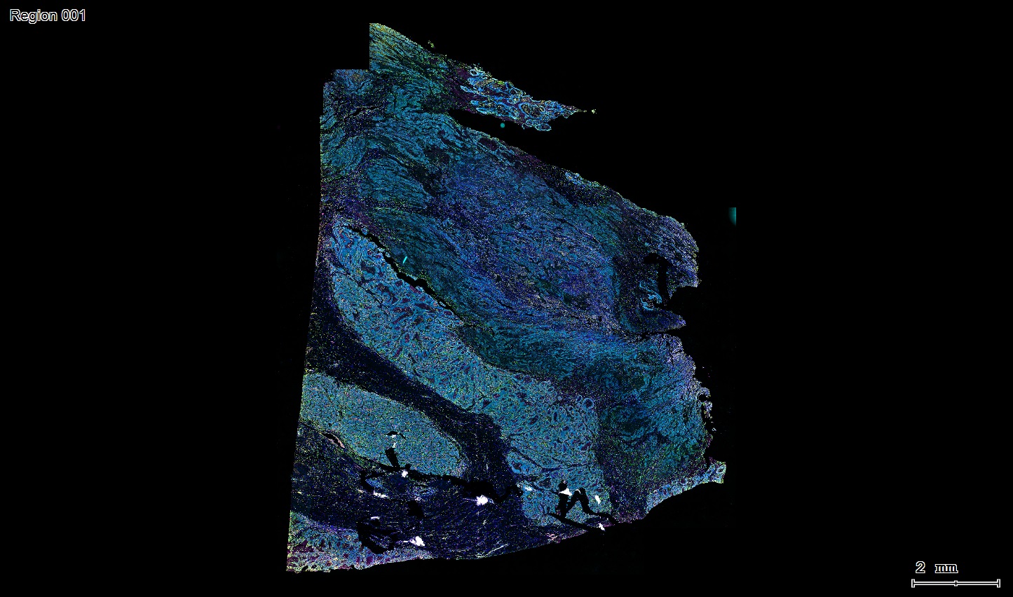 六标七色多重荧光检测试剂盒-IHCT005