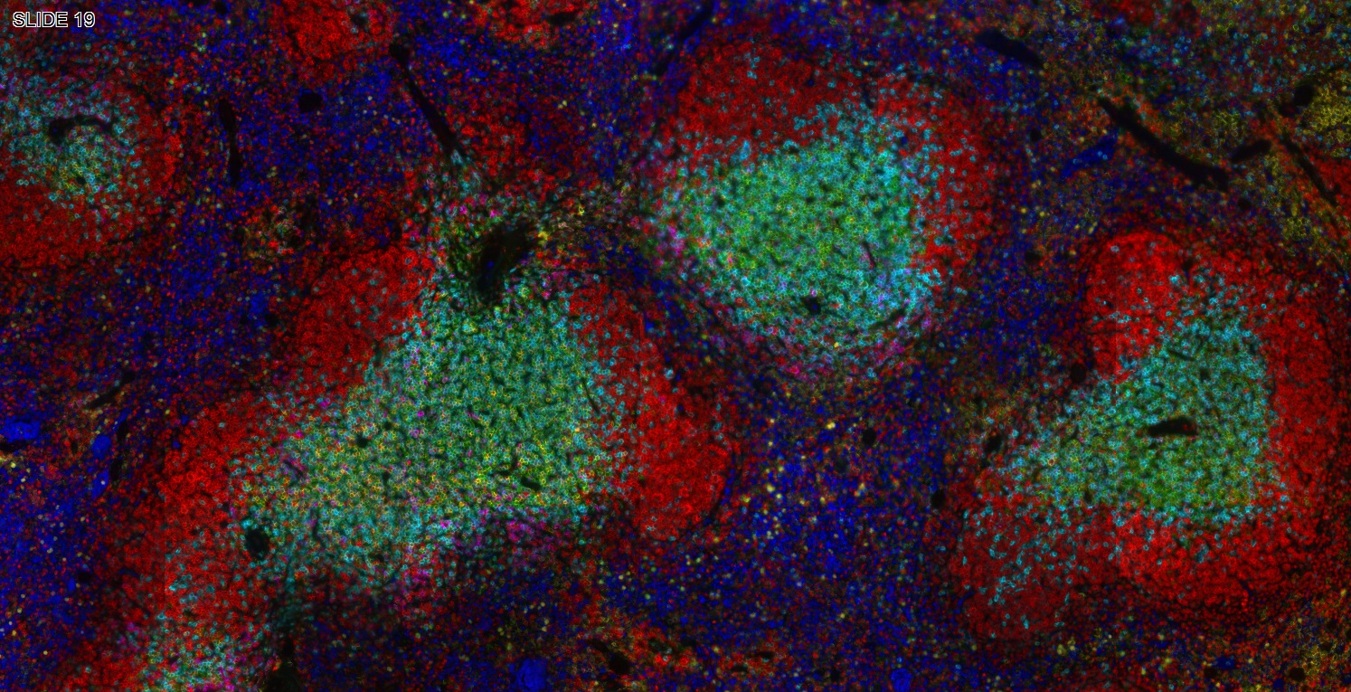 六标七色多重荧光检测试剂盒-IHCT005