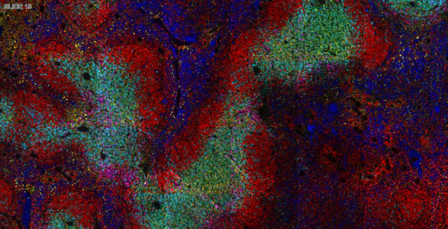 六标七色多重荧光检测试剂盒-IHCT005