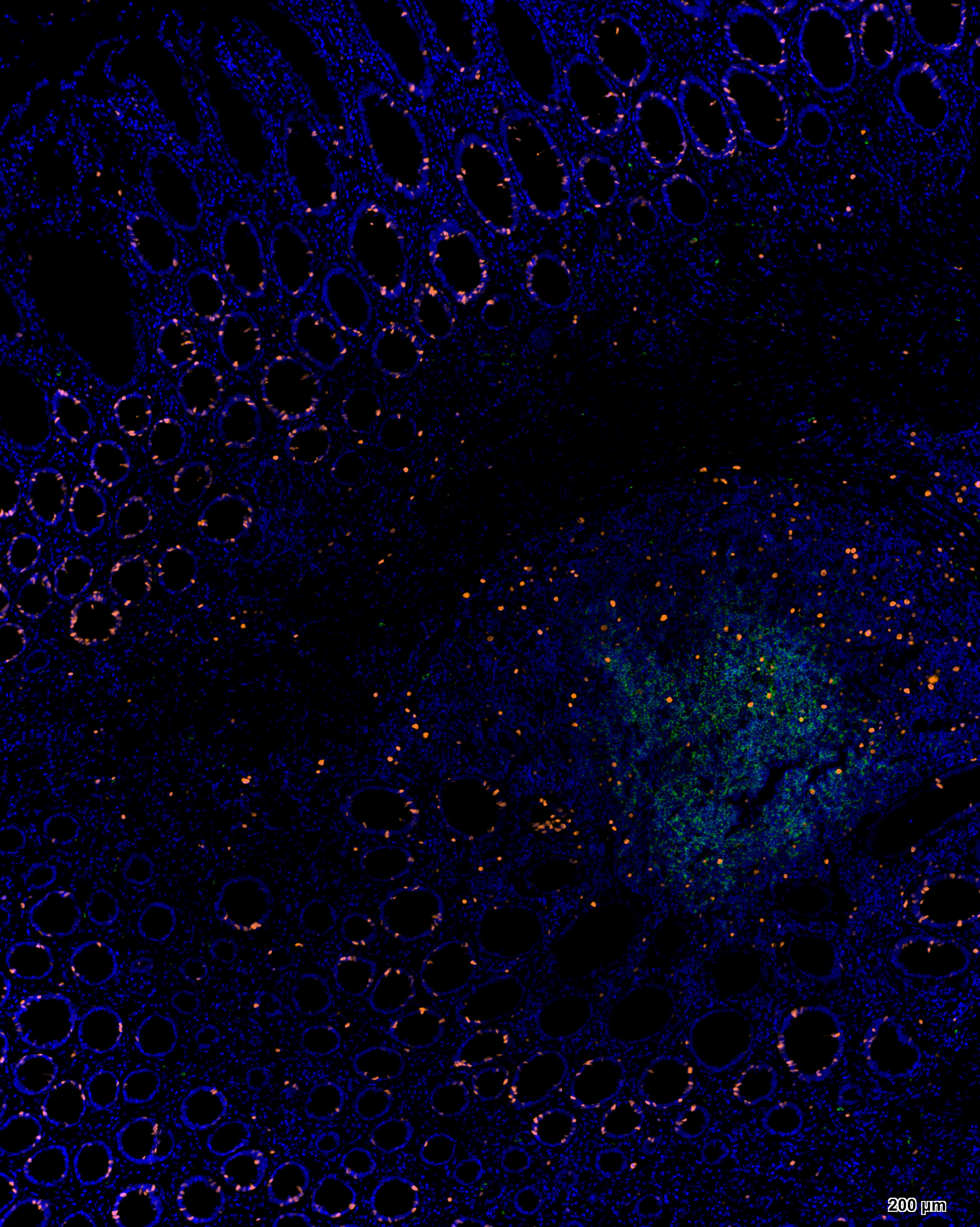 双标三色多重荧光检测试剂盒-IHCT001