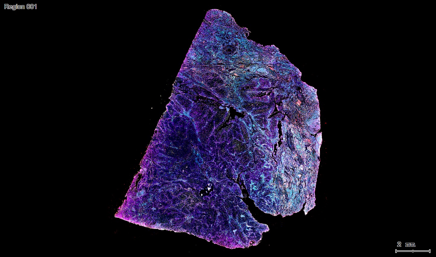 六标七色多重荧光检测试剂盒-IHCT005