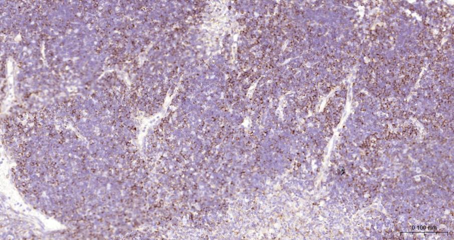 Ras GTP酶活化蛋白结合蛋白1重组兔单抗