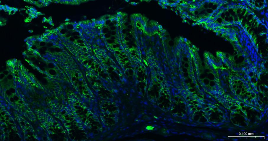 上皮细胞粘附分子（CD326）重组兔单抗