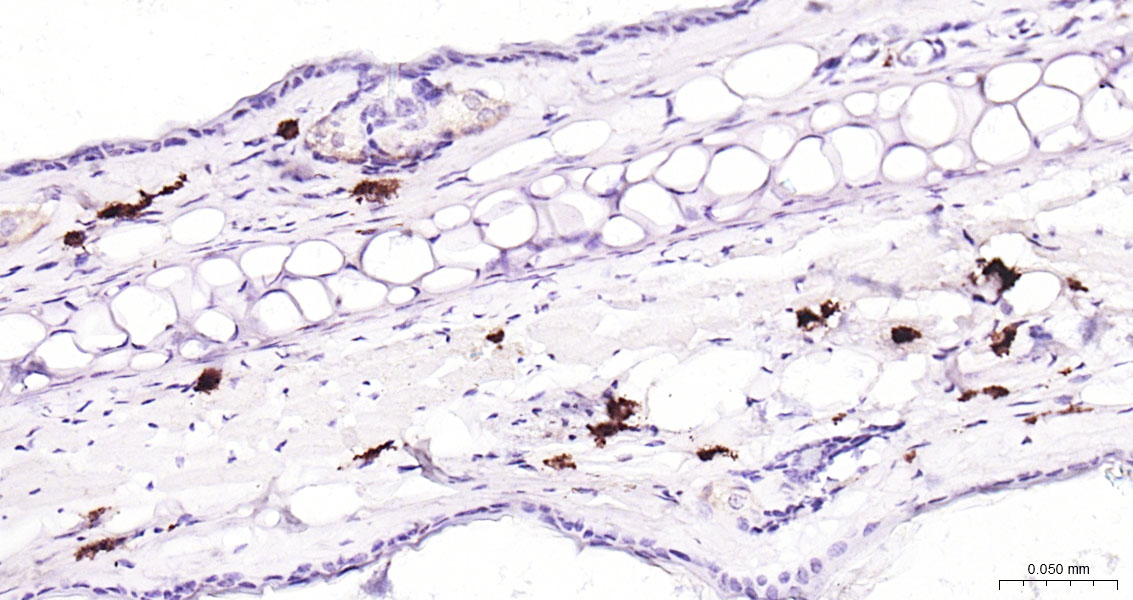 肥大细胞类胰蛋白酶重组兔单抗