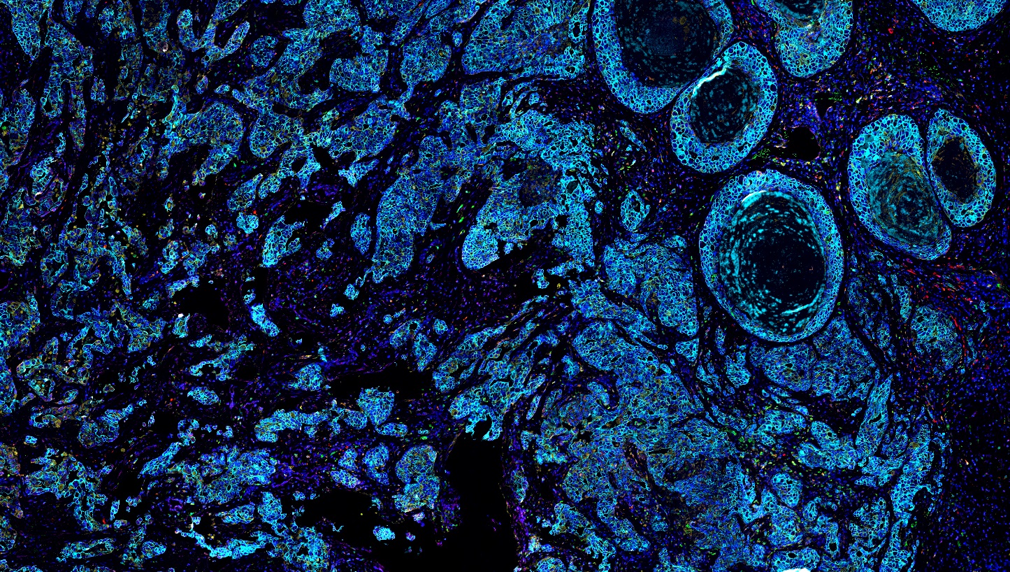 六标七色多重荧光检测试剂盒-IHCT005