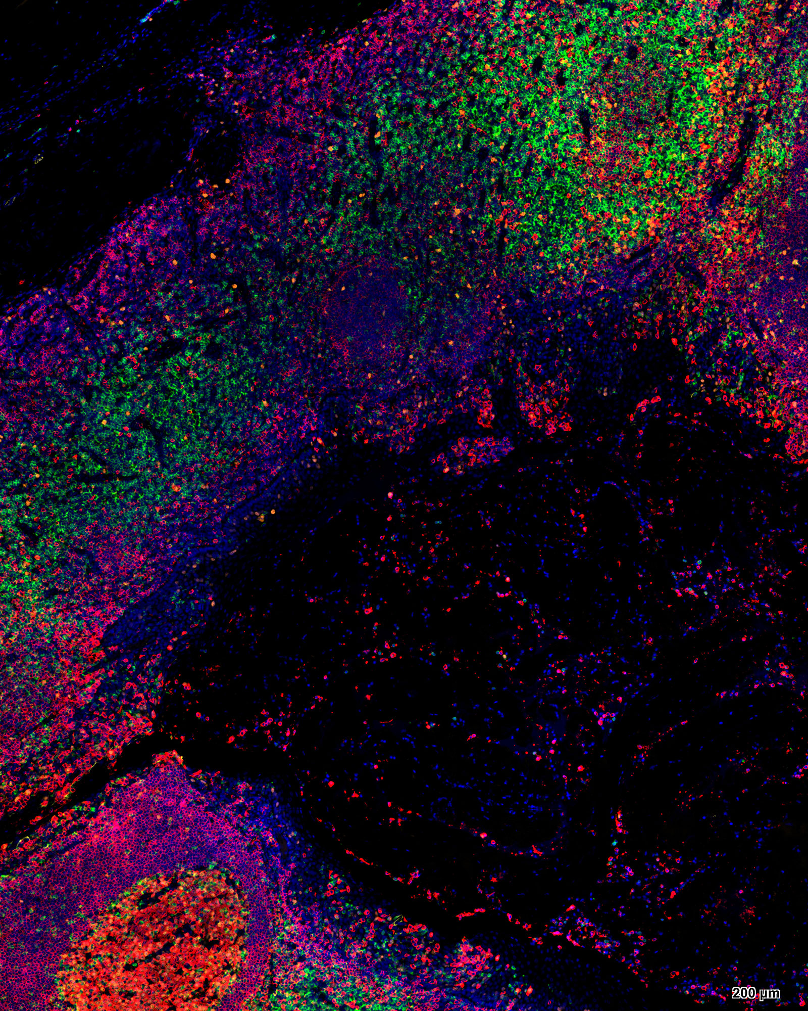 五标六色多重荧光检测试剂盒-IHCT004