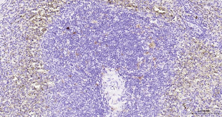 白细胞介素-18/干扰素γ诱导因子重组兔单抗