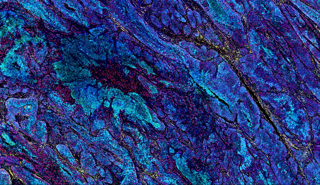 六标七色多重荧光检测试剂盒-IHCT005