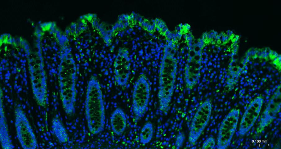 上皮细胞粘附分子（CD326）重组兔单抗