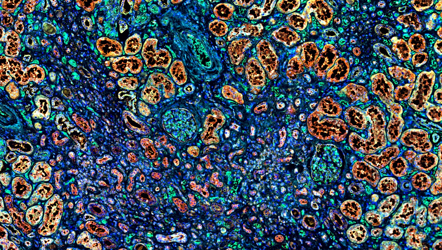 四标五色多重荧光检测试剂盒-IHCT003