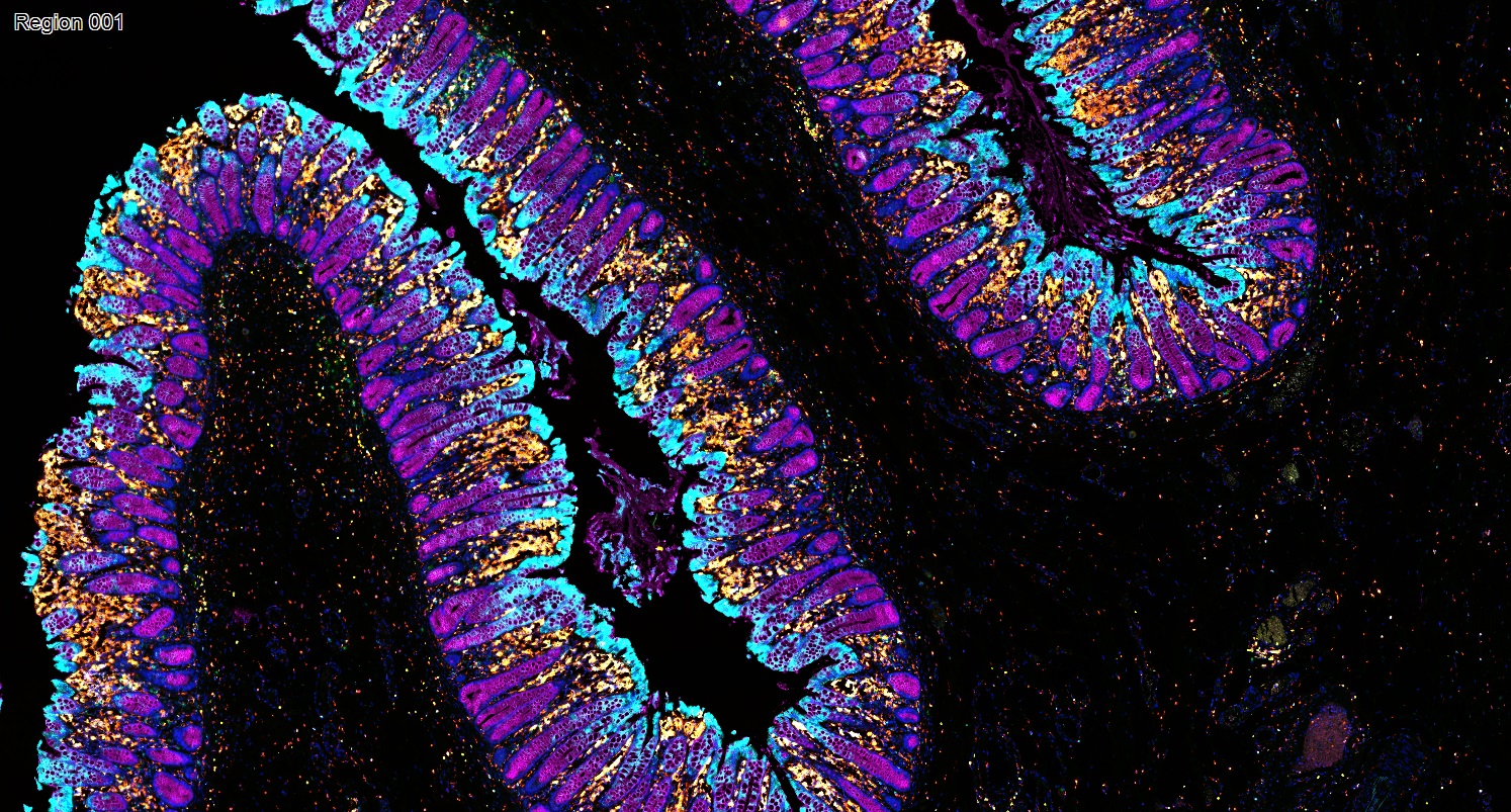 六标七色多重荧光检测试剂盒-IHCT005