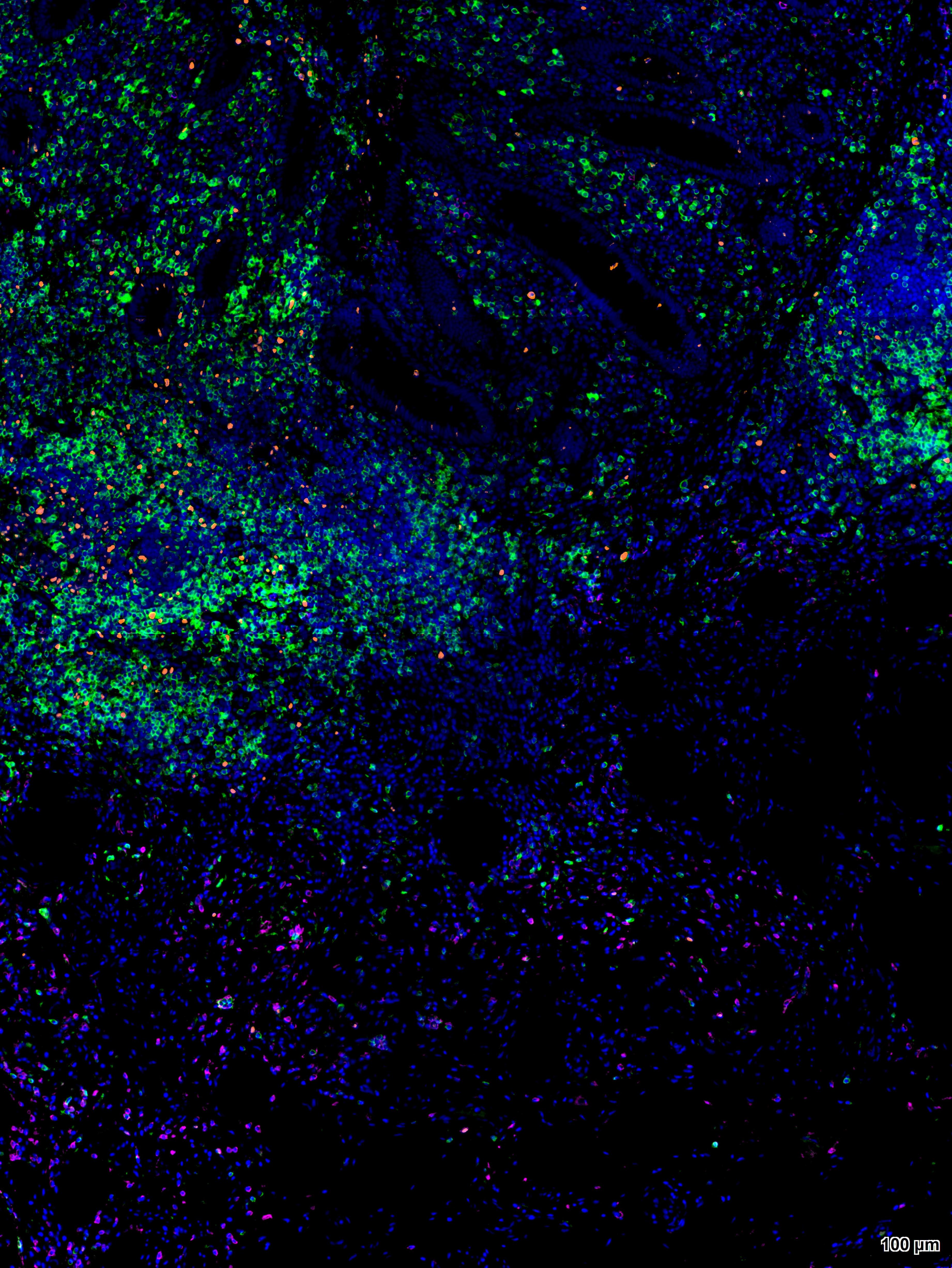 三标四色多重荧光检测试剂盒-IHCT002