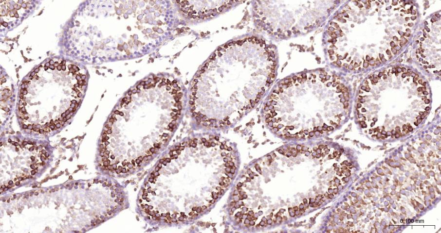 Ras GTP酶活化蛋白结合蛋白1重组兔单抗