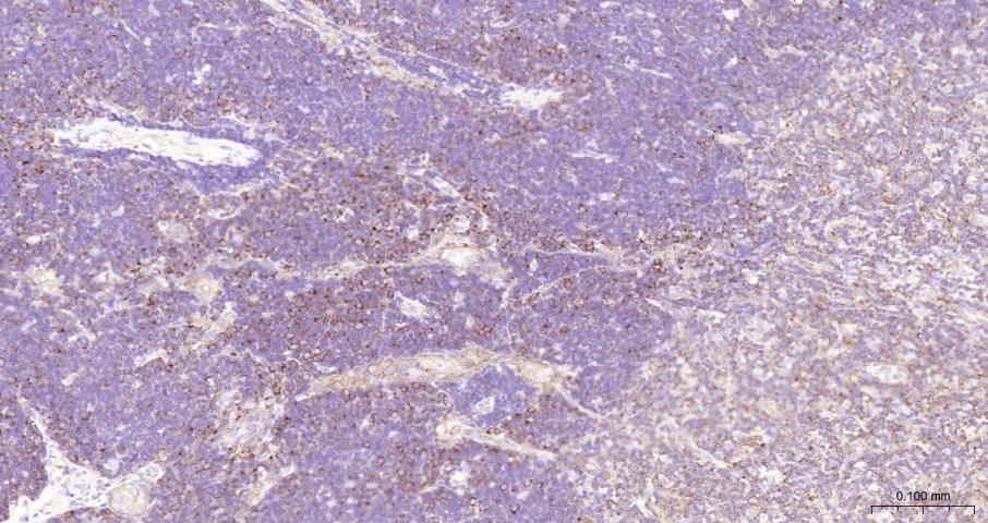 Ras GTP酶活化蛋白结合蛋白1重组兔单抗