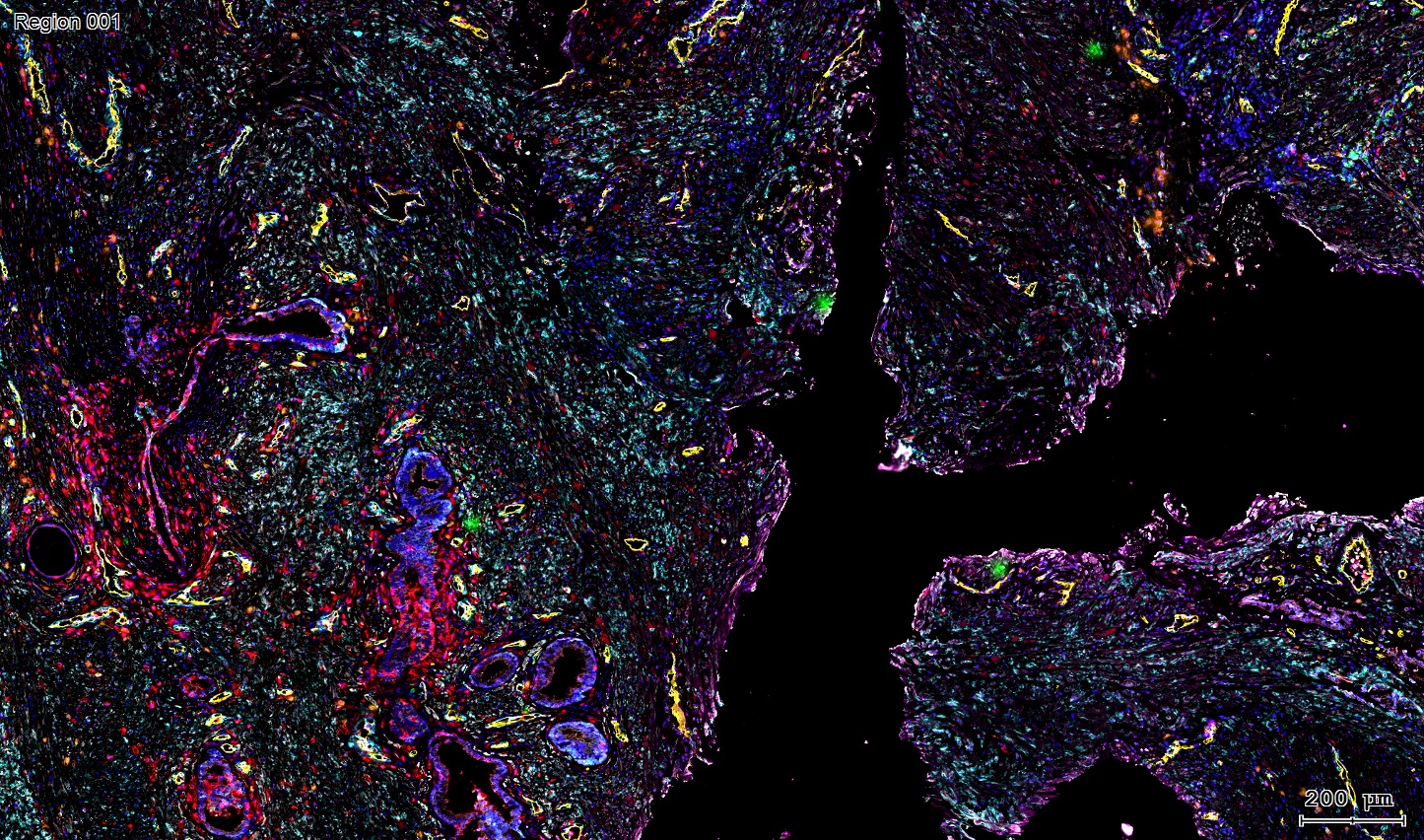 六标七色多重荧光检测试剂盒-IHCT005