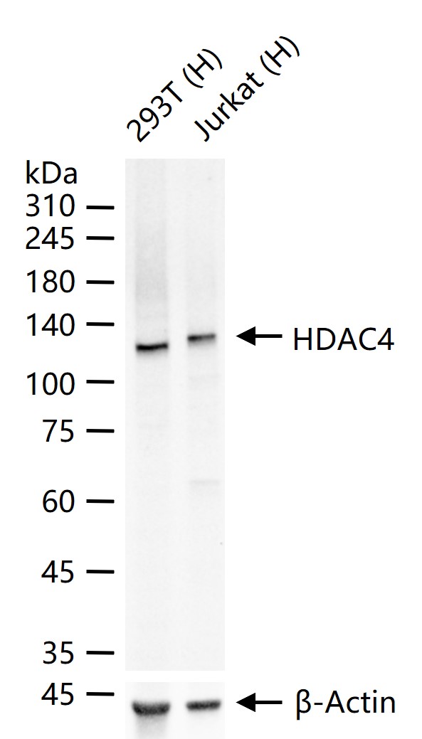 组蛋白去乙酰化酶4重组兔单抗