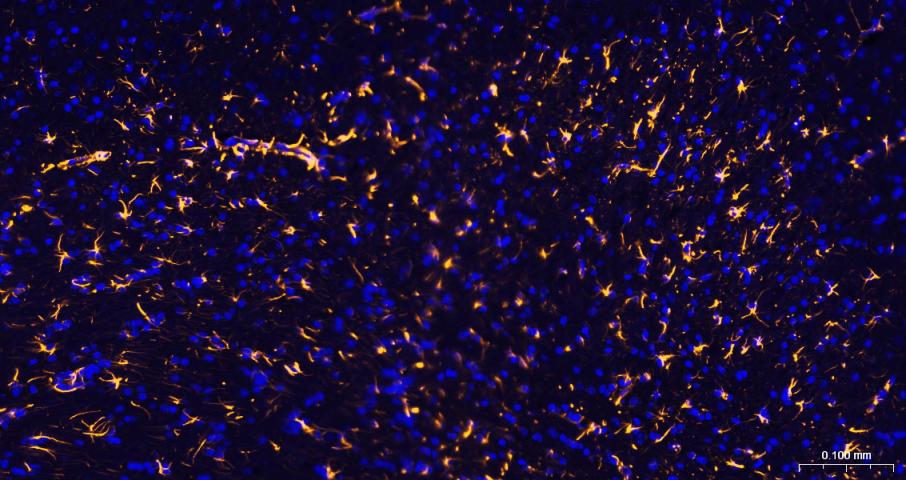 胶质纤维酸性蛋白重组兔单抗