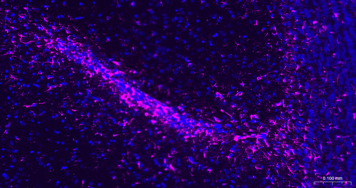 胶质纤维酸性蛋白重组兔单抗