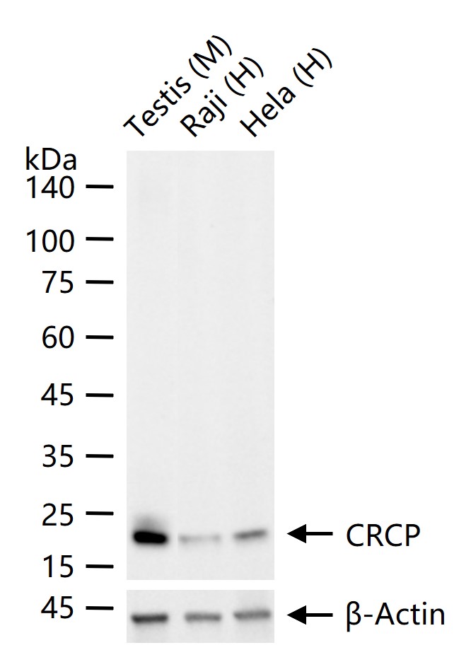 CRCP Recombinant Rabbit mAb (一抗) - WB,IHC-P,IHC-F,IF,IP | Bioss