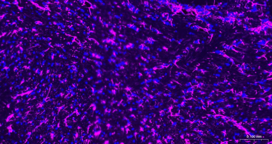 胶质纤维酸性蛋白重组兔单抗