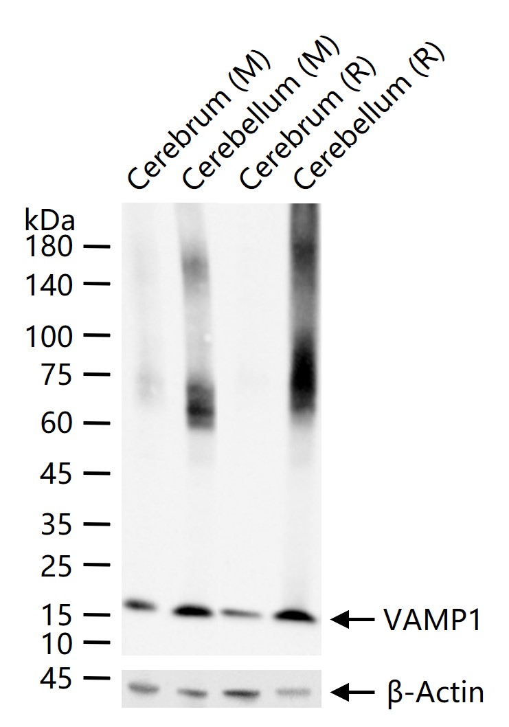 VAMP1 Recombinant Rabbit mAb (一抗) - WB,IHC-P,IHC-F,IF,ICC/IF | Bioss