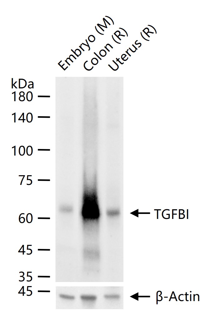 角膜上皮蛋白TGFBI重组兔单抗