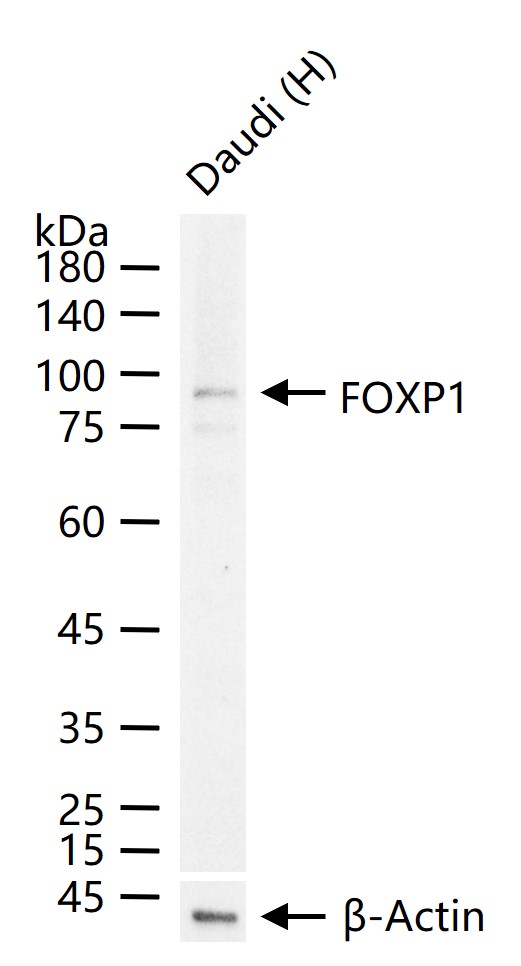 叉头蛋白P1重组兔单抗