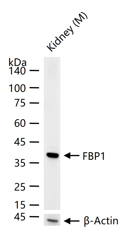 果糖1，6-二磷酸酯酶重组兔单抗