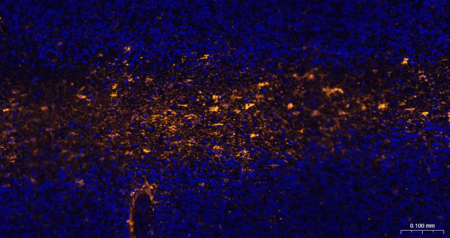 胶质纤维酸性蛋白重组兔单抗