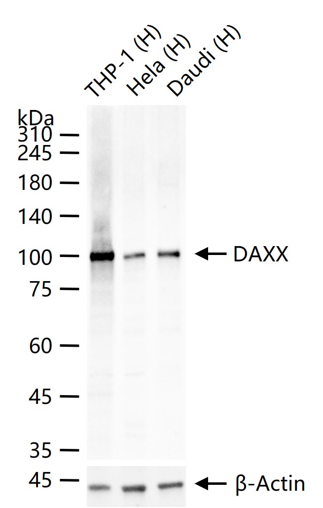 Fas相关死亡结构域蛋白重组兔单抗