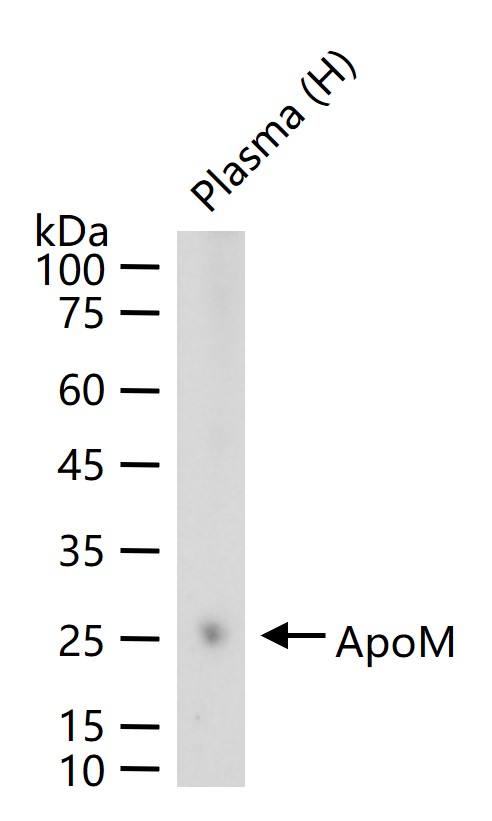 ApoM Recombinant Rabbit mAb (一抗) - WB,Flow-Cyt | Bioss