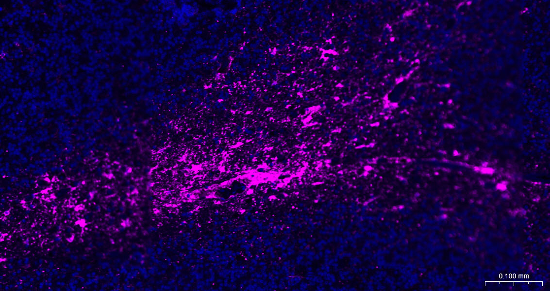 胶质纤维酸性蛋白重组兔单抗