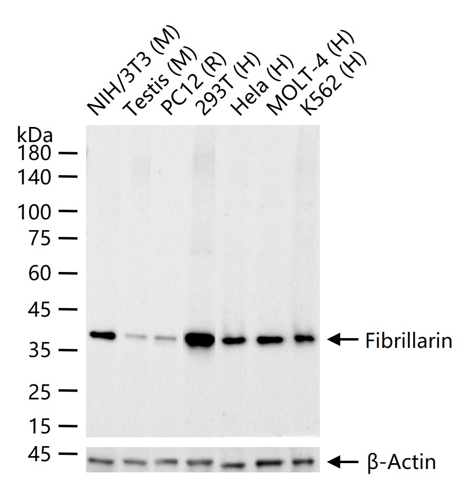 核仁纤维蛋白重组兔单抗