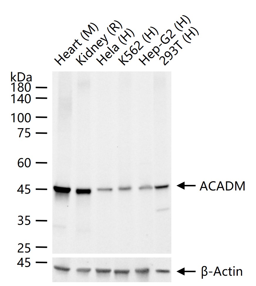 ACADM Recombinant Rabbit mAb (一抗) - WB,IHC-P,IHC-F,IF,Flow-Cyt,ICC/IF | Bioss