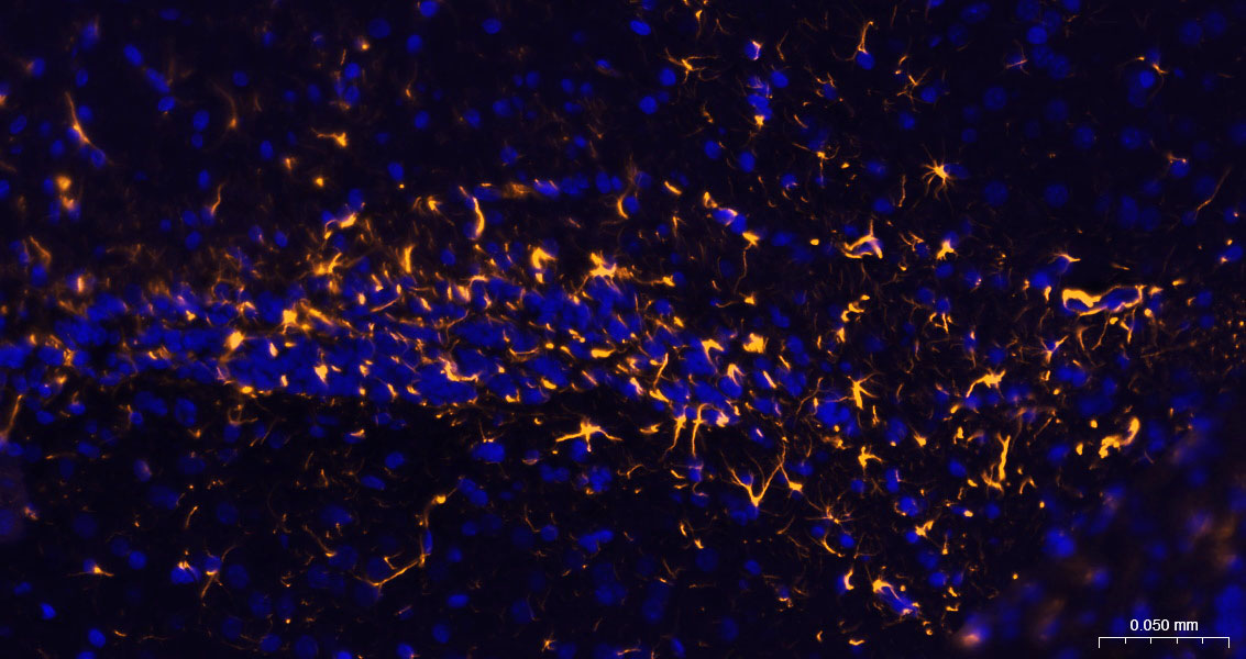 胶质纤维酸性蛋白重组兔单抗