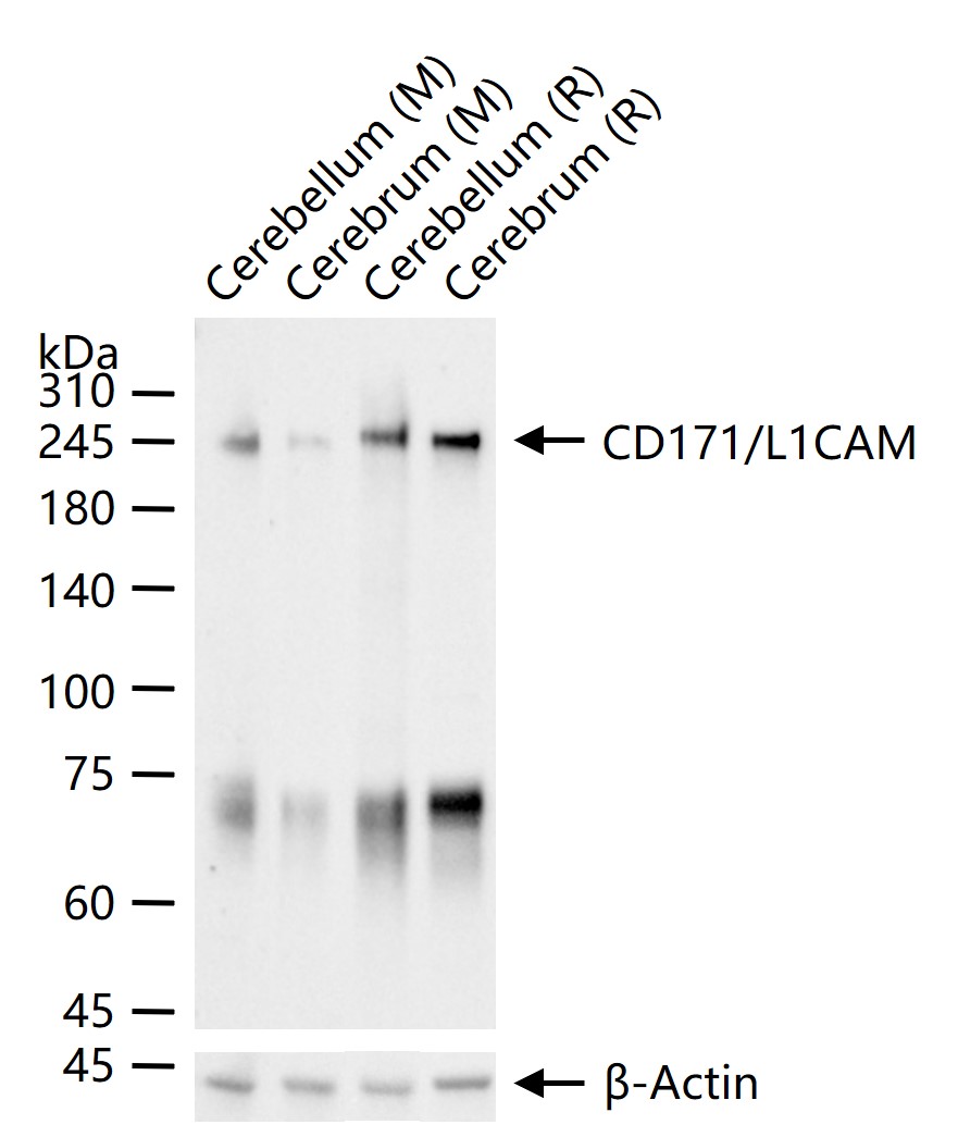 CD171/L1CAM Rabbit pAb (一抗) - WB | Bioss