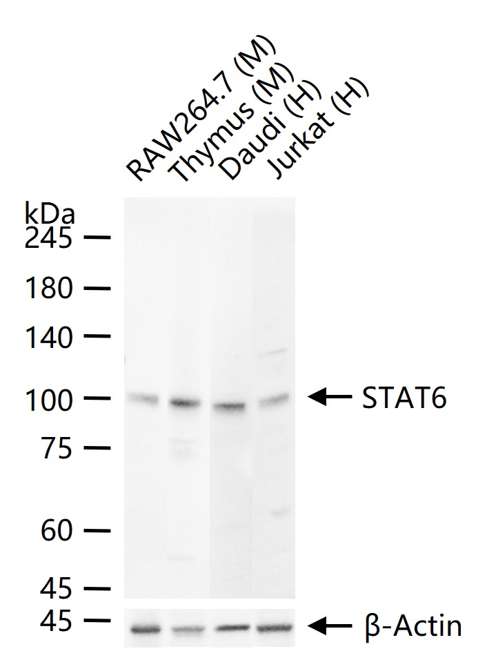 信号转导和转录激活因子6重组兔单抗