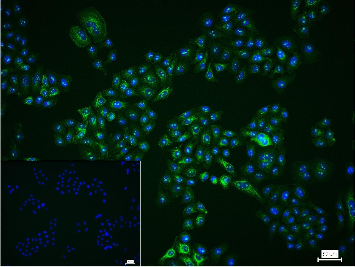核仁纤维蛋白重组兔单抗