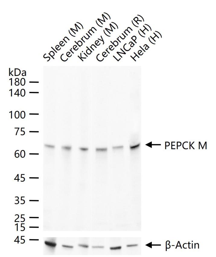 磷酸羧化酶2重组兔单抗