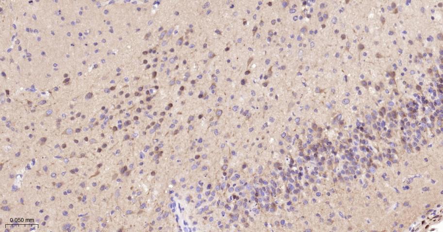 磷酸化蛋白激酶A α/β/γ重组兔单抗