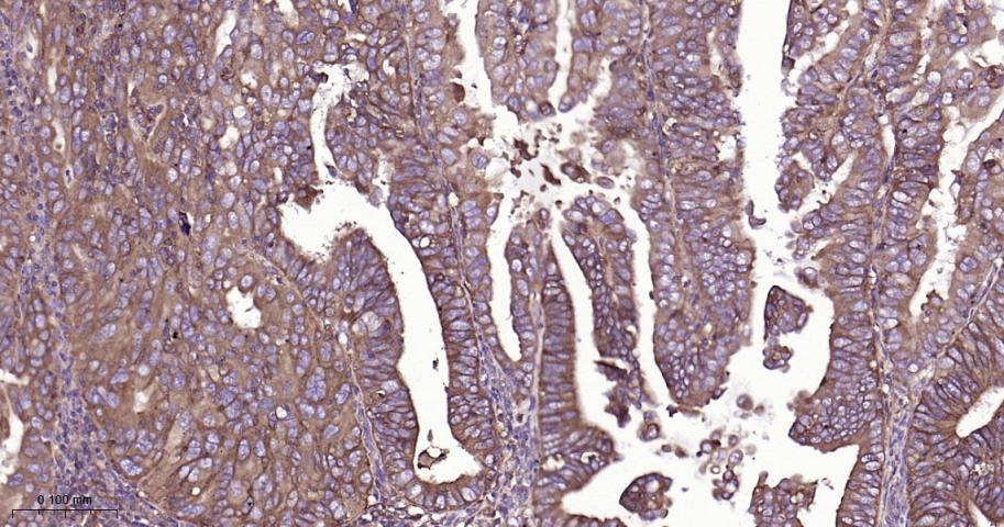 基质金属蛋白酶-14重组兔单抗