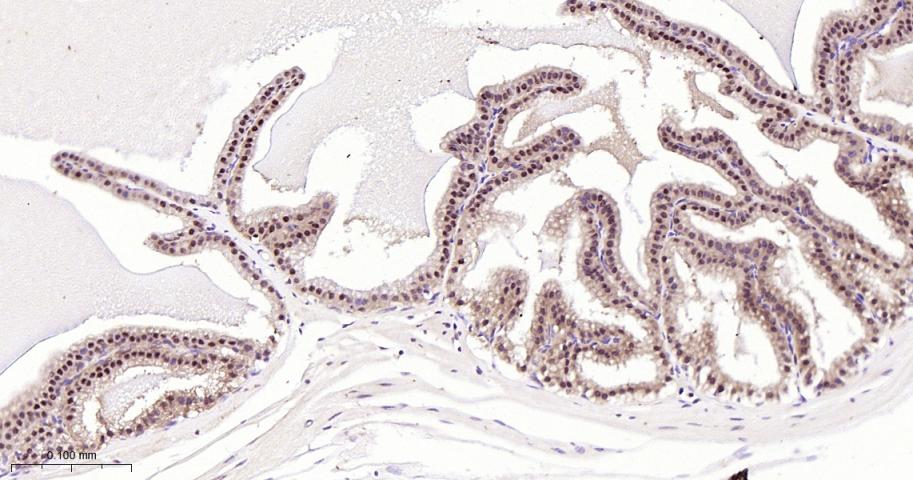 环指蛋白75重组兔单抗